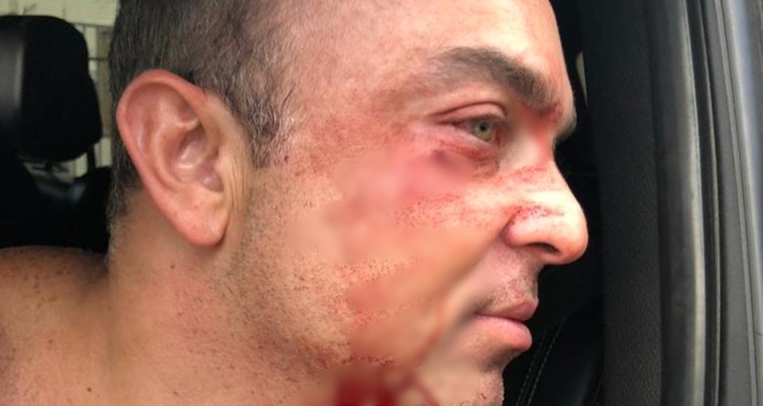 Secretário de Tião Viana é xingado em boate de Rio Branco e revida com agressão física; vídeo mostra confusão