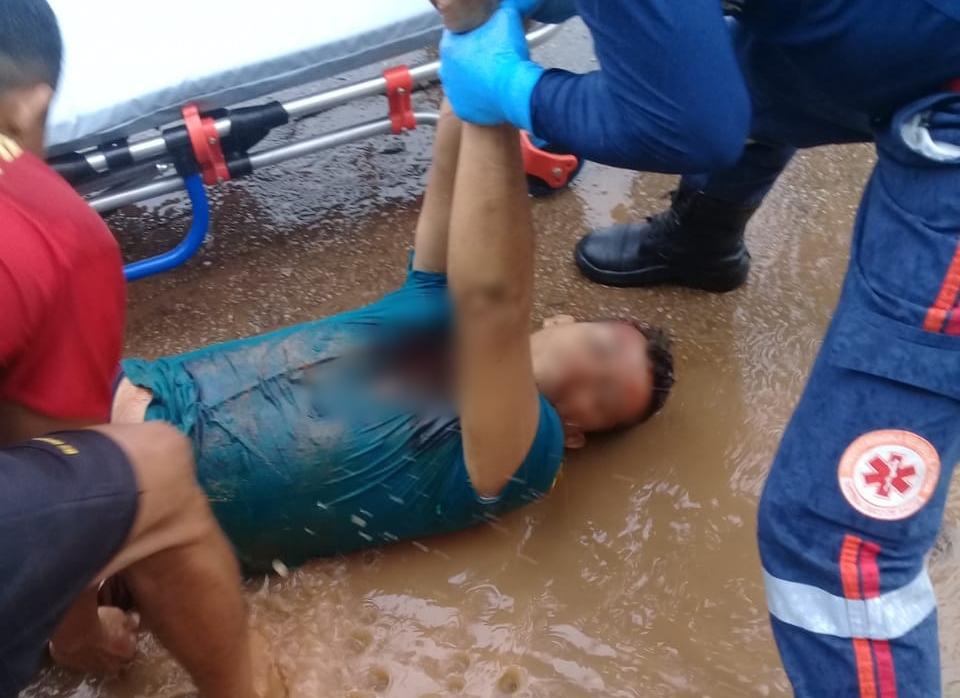Homem monitorado por tornozeleira, baleado no bairro Aeroporto Velho, morre no Pronto Socorro