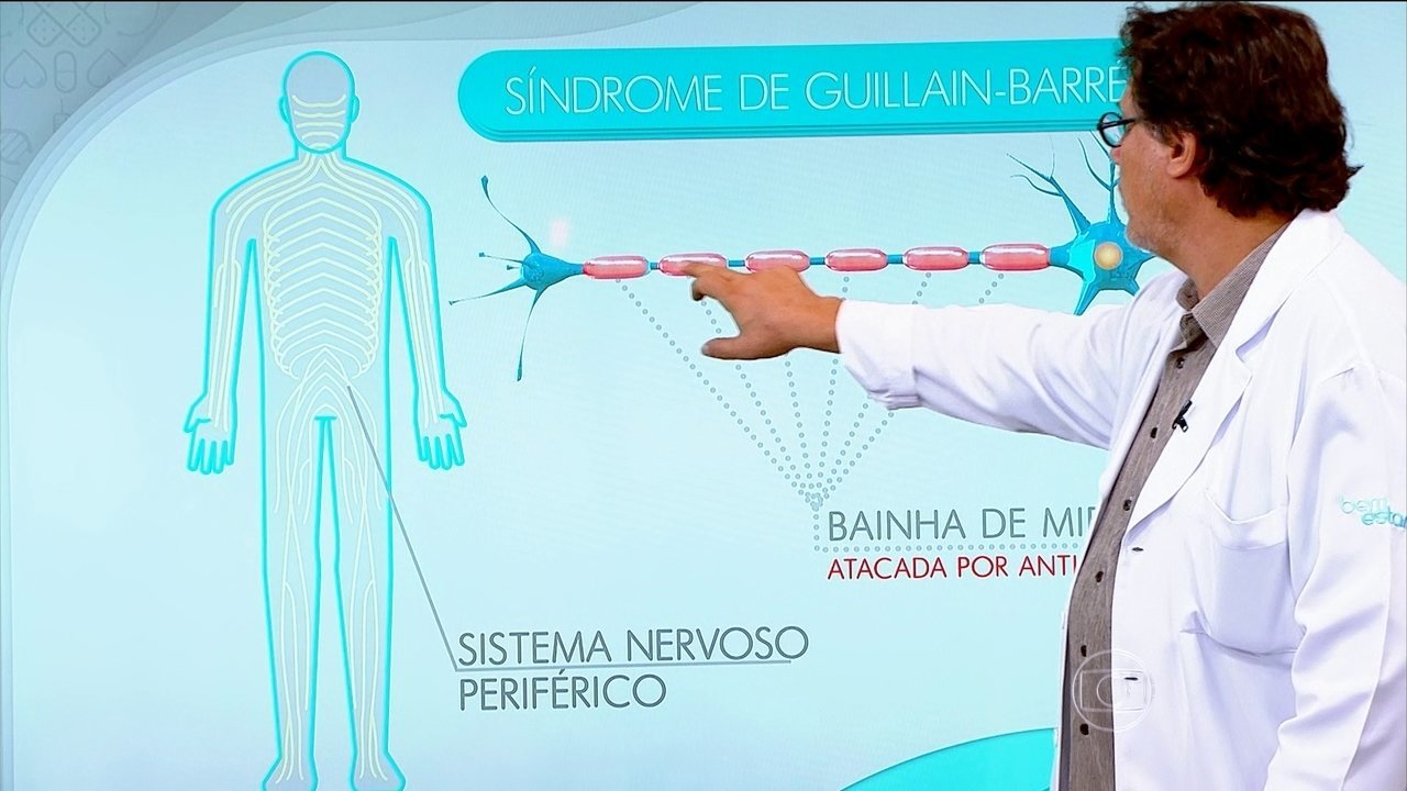 Conheça Guillain-Barré, síndrome rara e autoimune: ‘grave, rápida e aguda’, diz especialista
