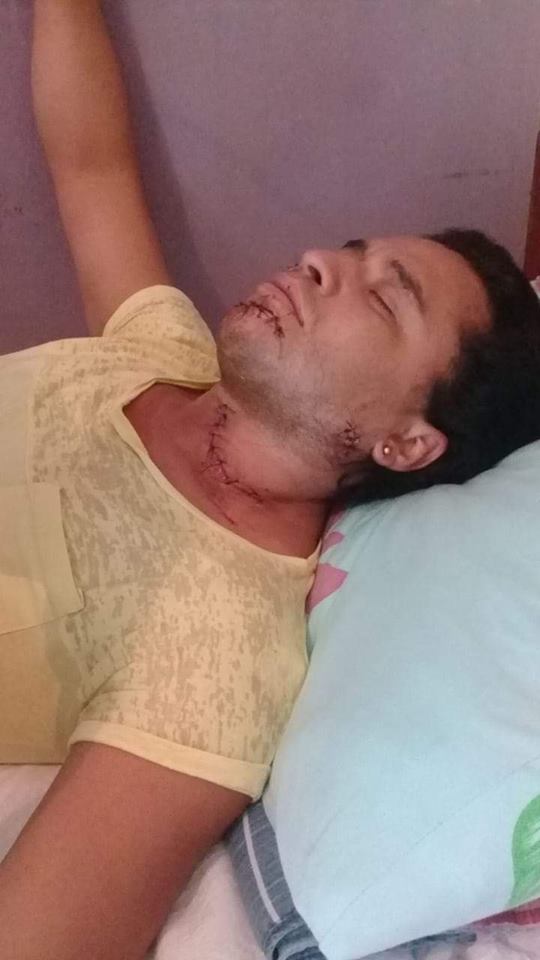 Homem corta garganta e rosto de gay enquanto bebiam em uma festa