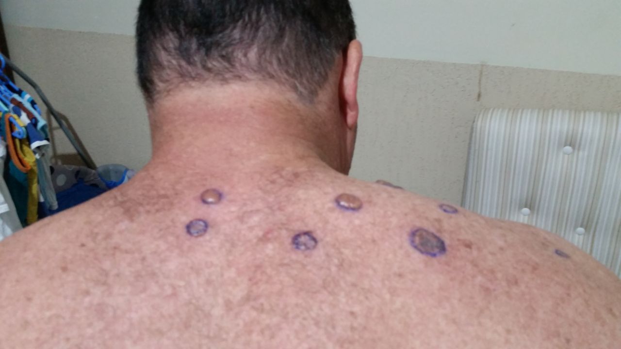 Acreano, em tratamento de câncer, pede ajuda após ter carro roubado com medicamentos e laudos