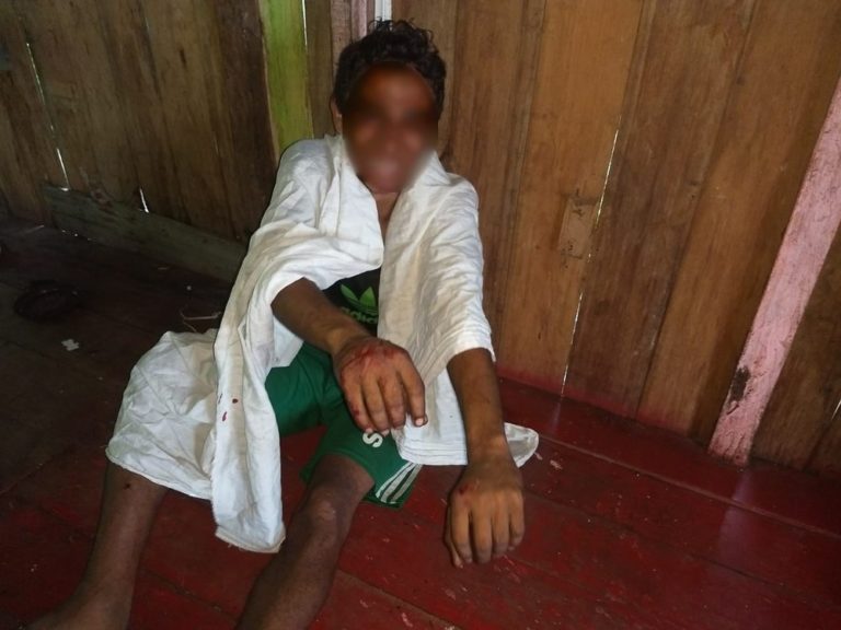 Homem amarrado e com tiros nas mãos é resgatado por PMs antes de ser morto por facção