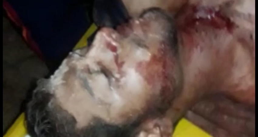 Jovem cai de cavalo, tem crânio quebrado após levar coice e está em coma no PS