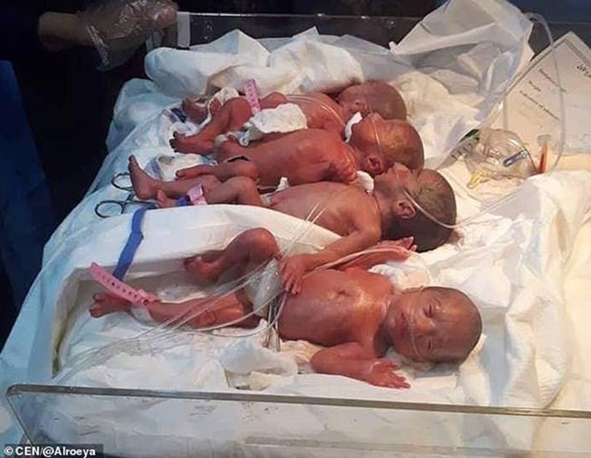 Raríssimo: mãe de 25 anos dá à luz naturalmente a sete bebês