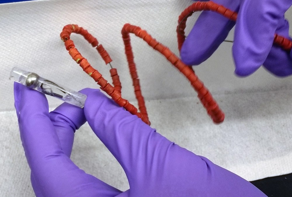 Tuberculose pode ser tratada com ‘colar de comprimidos’ inserido no estômago de paciente, diz estudo