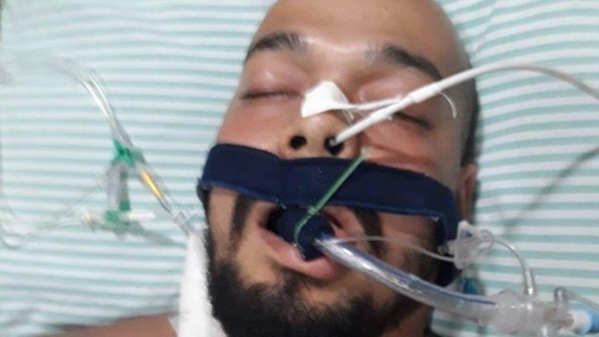 Chefe do tráfico no RJ se fere com fuzil e alega ‘acidente de trabalho’