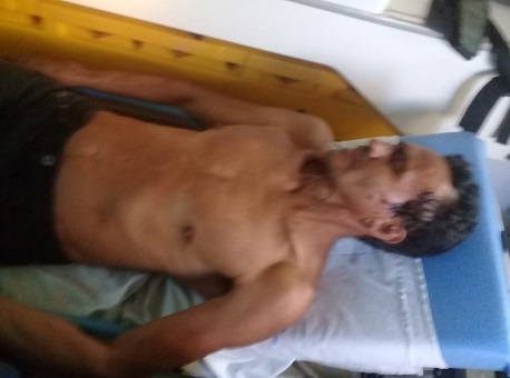 Homem de 51 anos é atingido com quatro tiros de escopeta em Sena Madureira