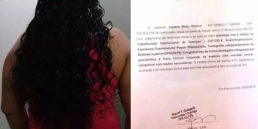 Acreana coloca o próprio cabelo à venda para custear tratamento de câncer e ajudar filha