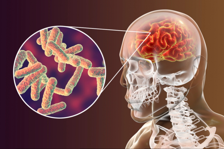 Prefeitura de Cruzeiro do Sul se previne contra os casos de meningite