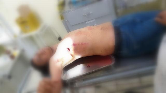 “Salva vidas” de rodeio é ferido a chifrada neste domingo, em Sena Madureira