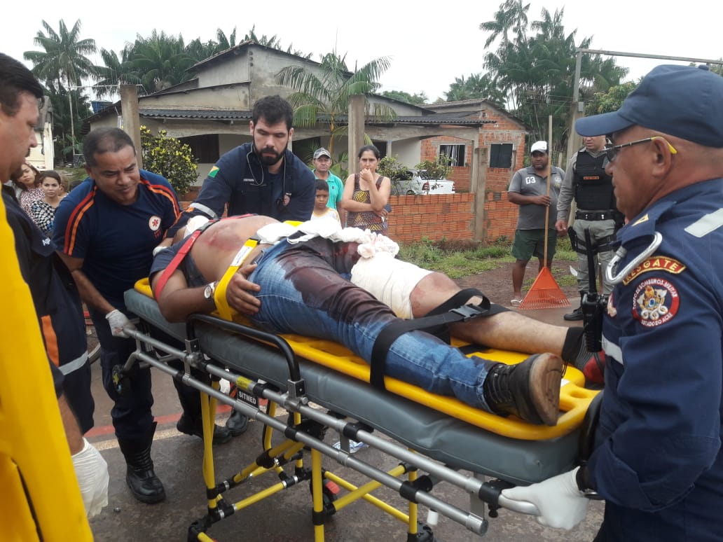 Moto bate em carreta e motociclista é levado em estado grave para o PS