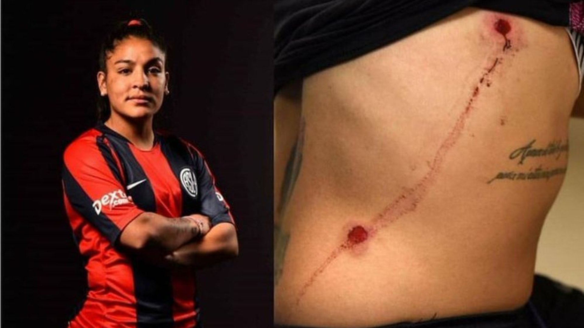 Jogadora é baleada no enterro do irmão, mas decide entrar em campo horas depois
