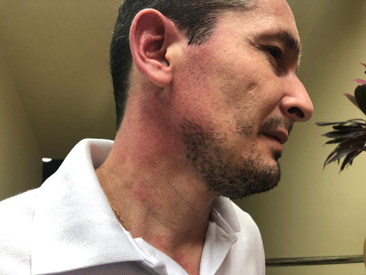 Atingido com spray de pimenta, sindicalista diz que vai entrar com ação criminal contra seguranças