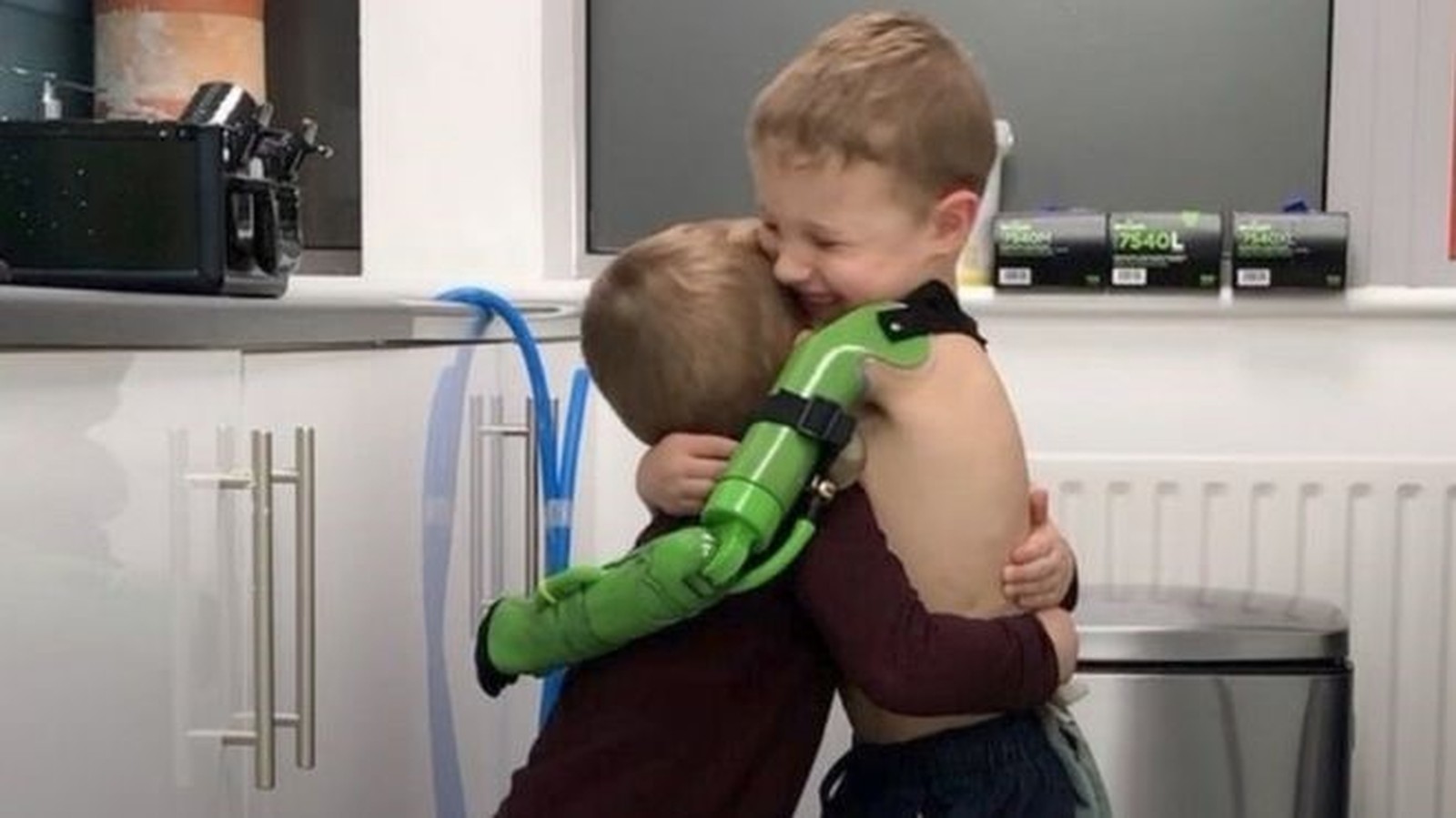 Menino de 5 anos ganha prótese de braço e abraça irmão pela primeira vez