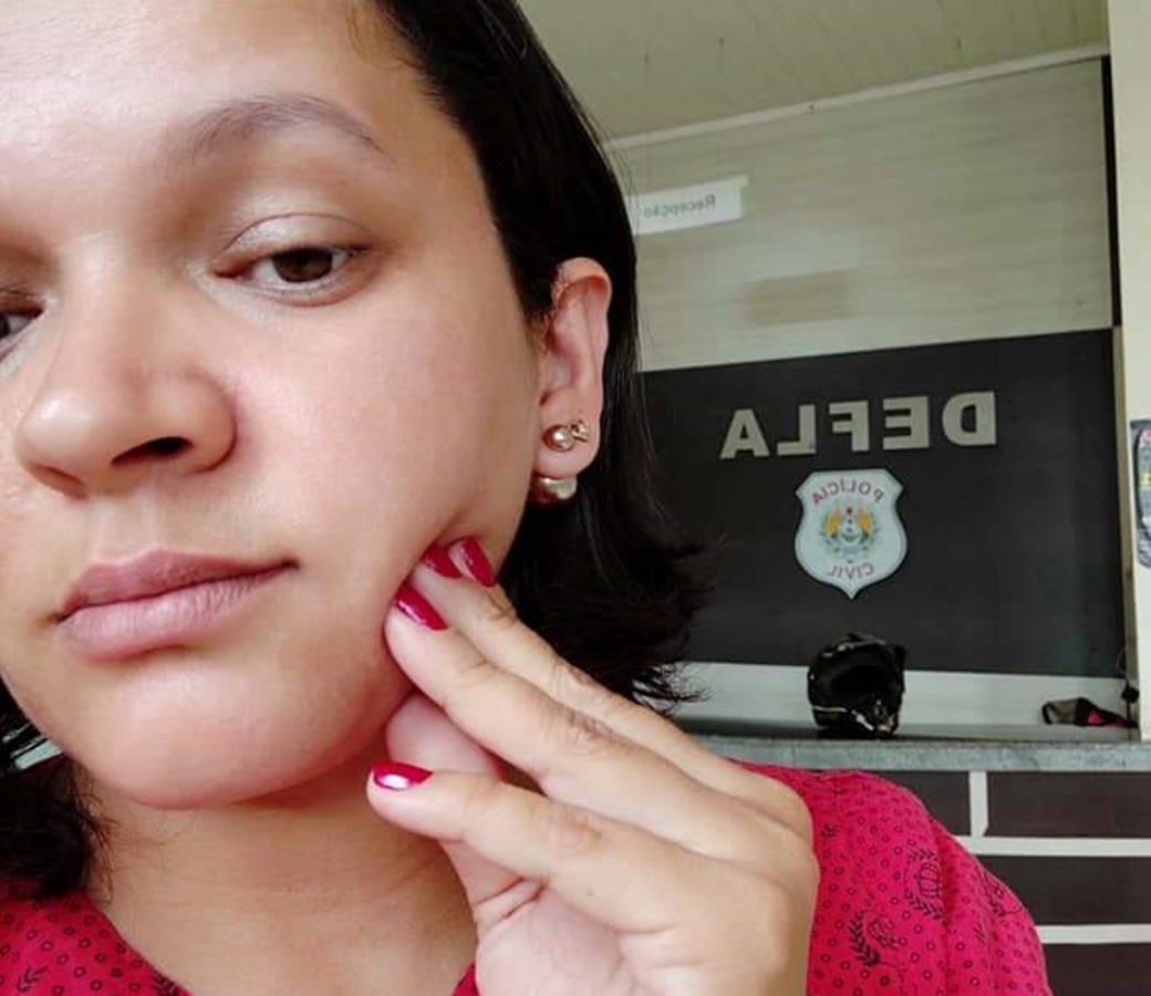 Servidora da Upa é agredida a tapas por paciente no Segundo Distrito de Rio Branco