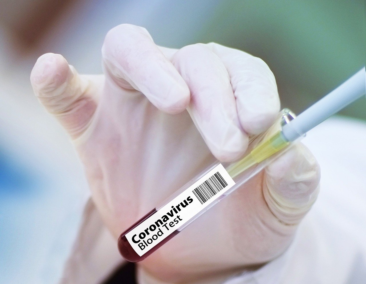 Saiba como é feito o exame para diagnosticar casos de coronavírus no Acre