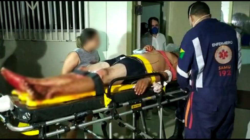 Bandidos fazem tocaia e ferem homem com 5 tiros na frente da própria casa, na Capital