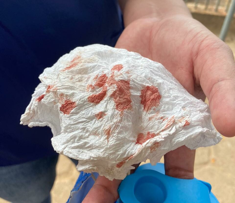 Dentista diz que recebeu chutes de policiais civis e foi sufocado em abordagem na capital