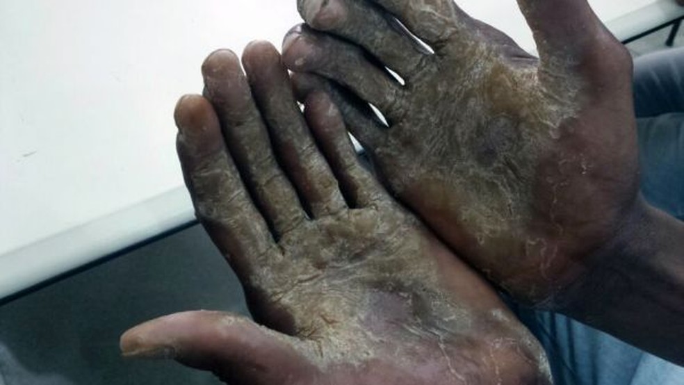 Doméstica é mantida em trabalho análogo à escravidão por 35 anos
