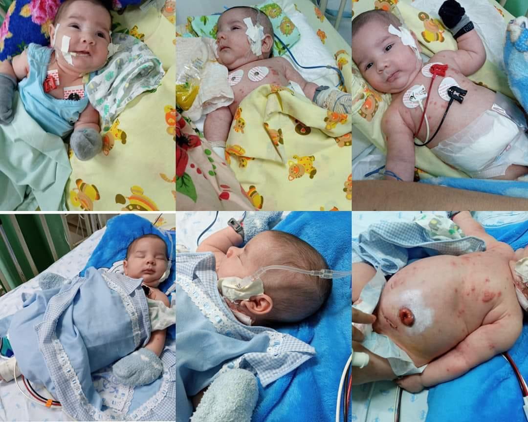 No Acre, bebê nasce com doença rara e família pede ajuda para tratamento