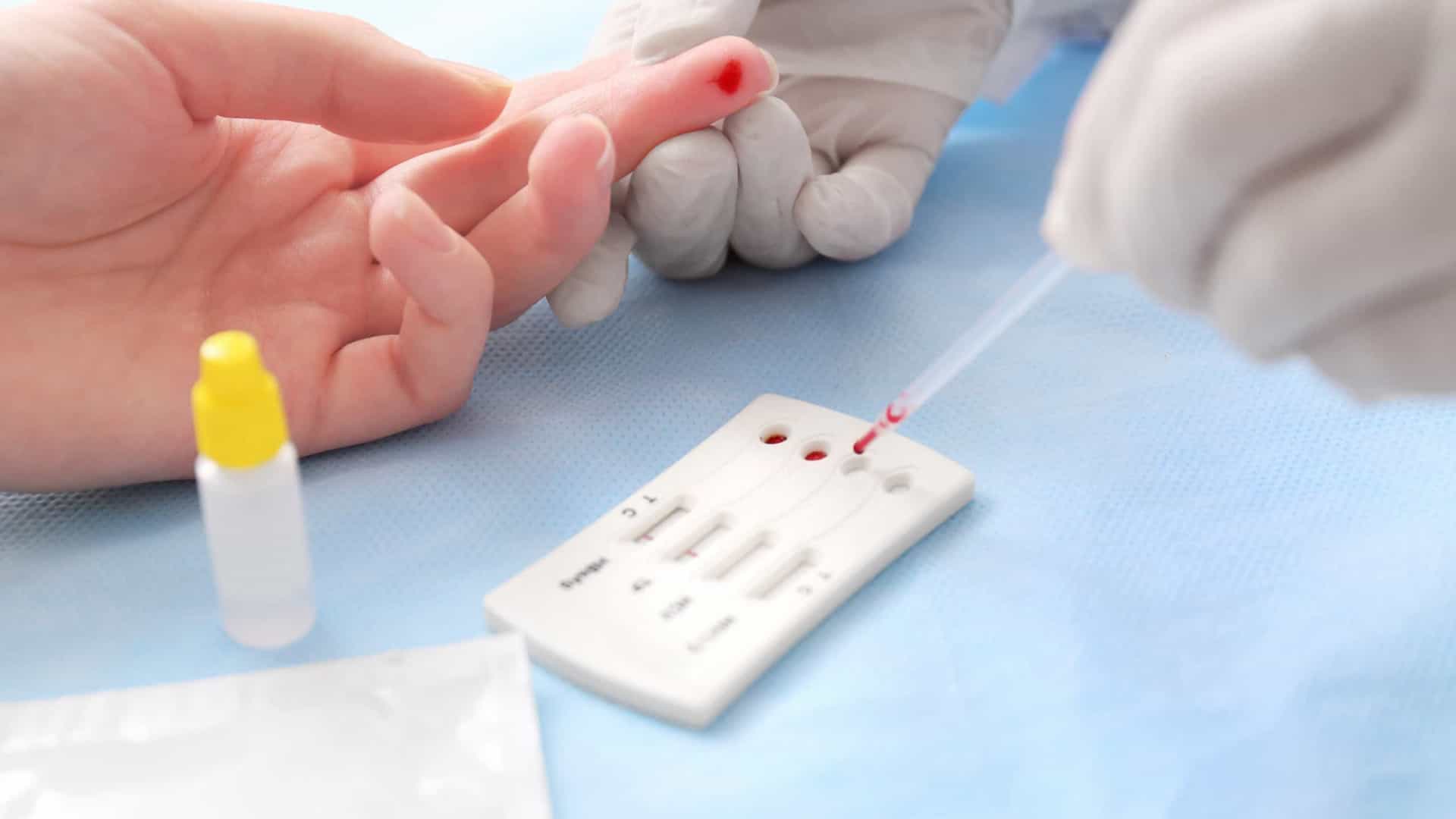 Universidade de SP relata tratamento que elimina HIV de paciente