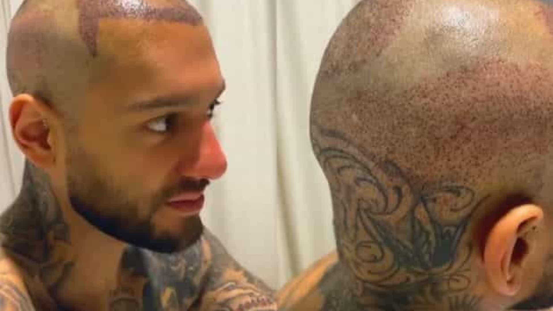 Lucas Lucco aparece careca e revela que fez implante capilar