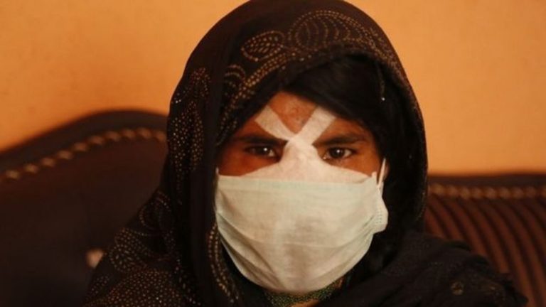 Obrigada a se casar, jovem tem o nariz cortado pelo marido