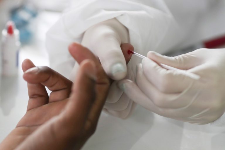 Acre registra 49 novos casos de coronavírus e um óbito neste domingo