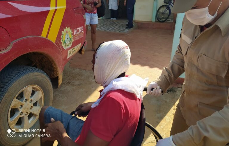 Homem é atingido por galho de árvore durante derrubada no Cassiriam