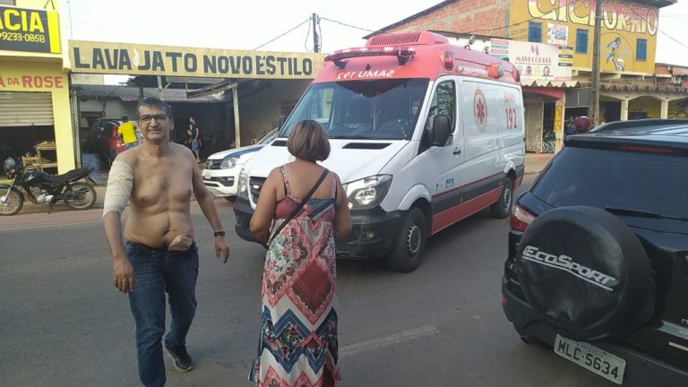 Homem é baleada ao jogar celular no chão durante assalto na Baixada da Sobral