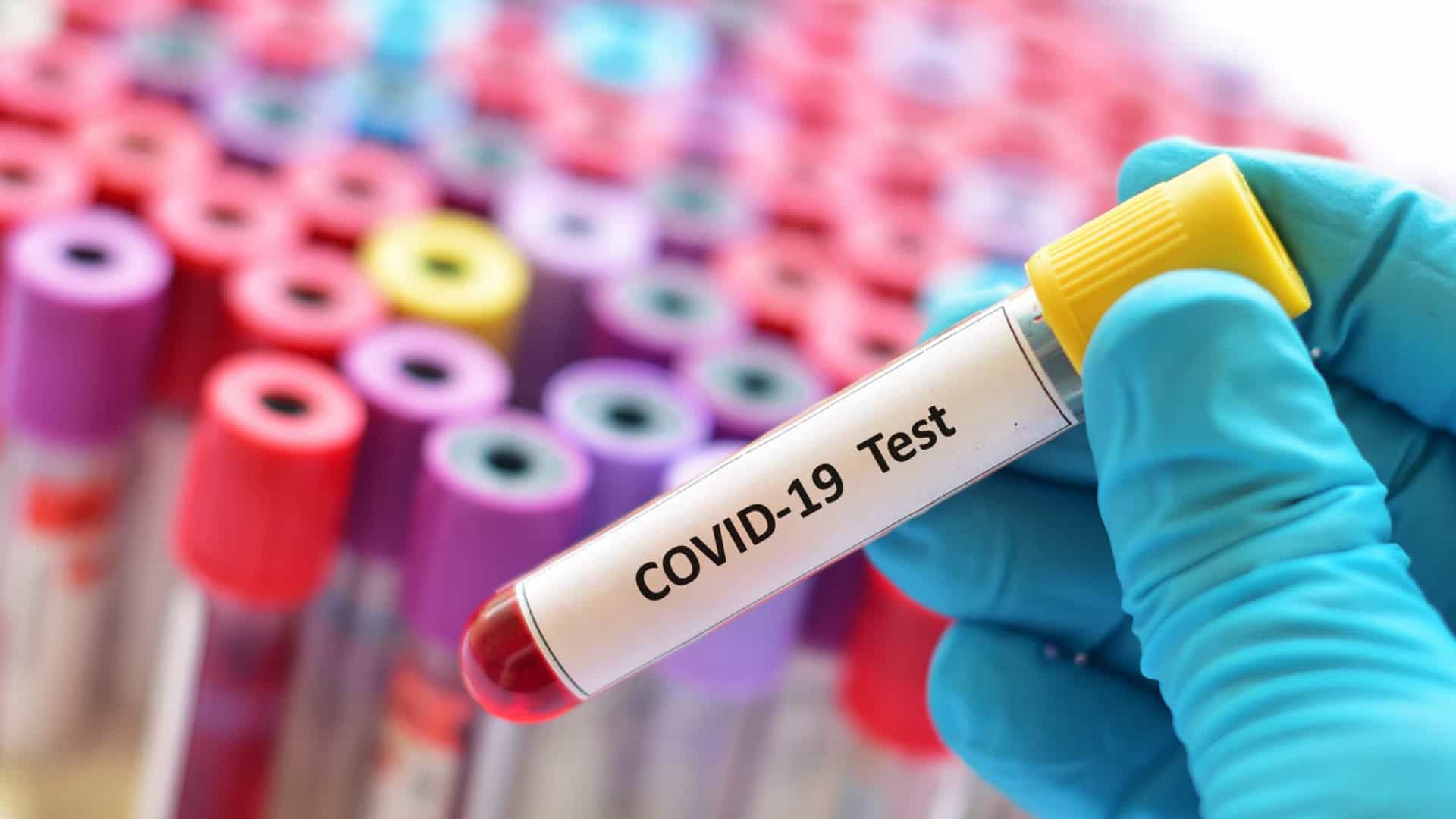 Covid-19: Atlético-GO obtém aval para usar atletas que deram positivo