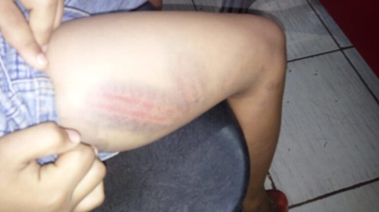 Mãe é presa após surrar a filha de 13 anos com fio de chapinha por ter saído de casa