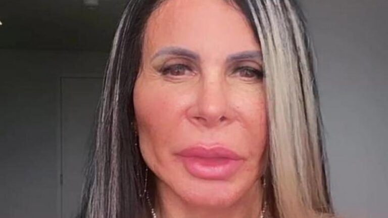 Gretchen exibe resultado de harmonização facial: “Tudo novo, bonito de novo”