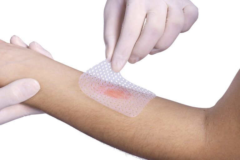 Acreana será indenizada após queimaduras graves durante procedimento estético