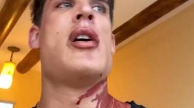 Tiago Ramos surge coberto de sangue e diz que levou uma facada: “Quase morri”