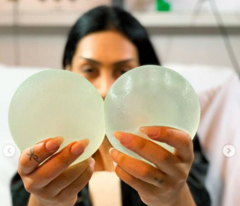 Ex-BBB retira silicone: ‘Mal sabia a maldade que estava fazendo com meu corpo’