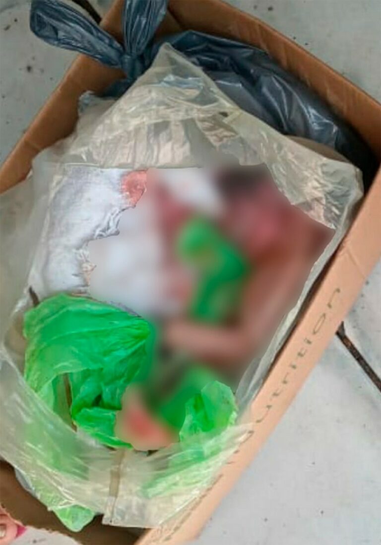 RO: Feto com cordão umbilical é achado em lixeira e polícia tenta identificar mãe