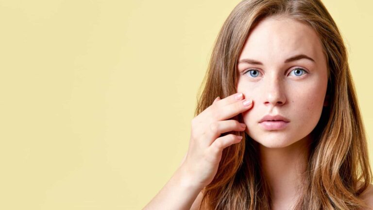 Três poderosas soluções caseiras para acabar com a acne