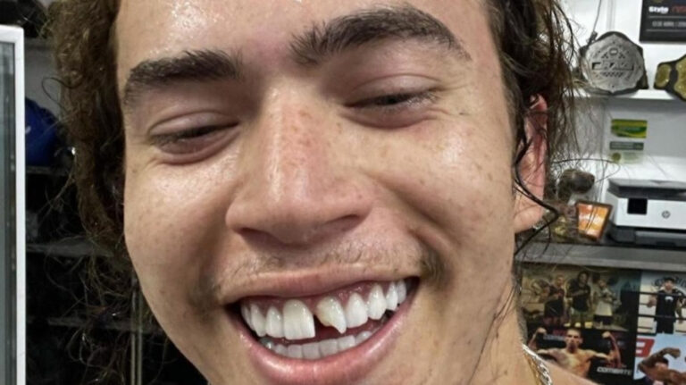 Whindersson Nunes quebra o dente em treino para enfrentar Popó