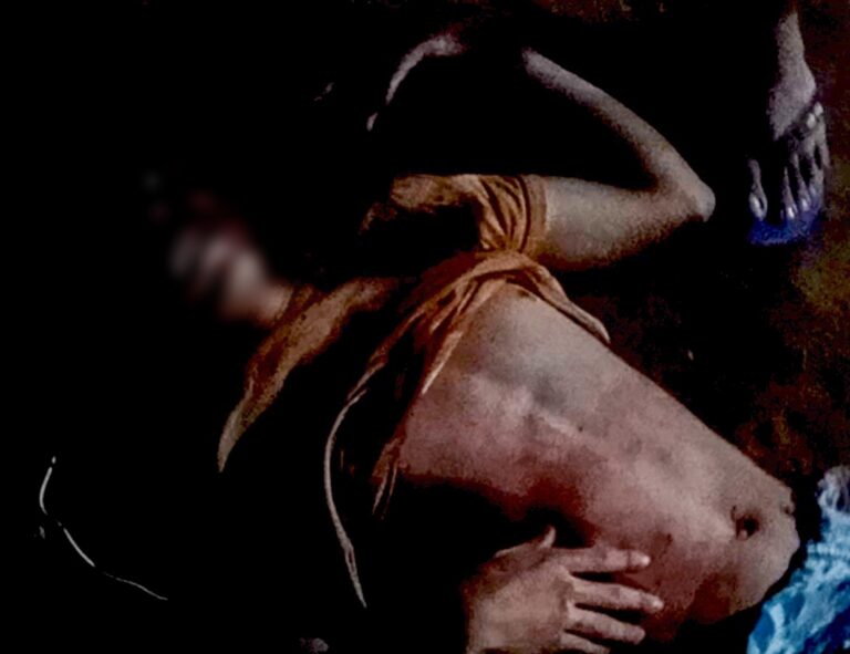 Adolescente é ferido com 6 tiros enquanto caminhava em rua no Belo Jardim I