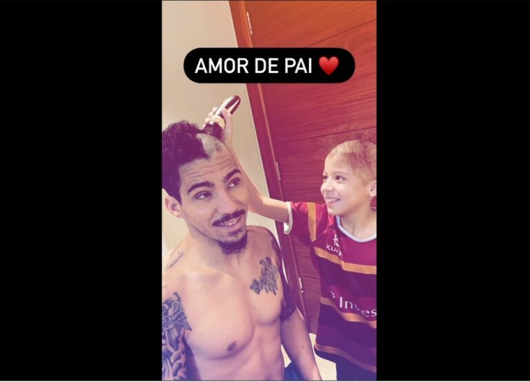 Jogador Allan raspa cabeça em solidariedade ao filho, que sofre de doença autoimune