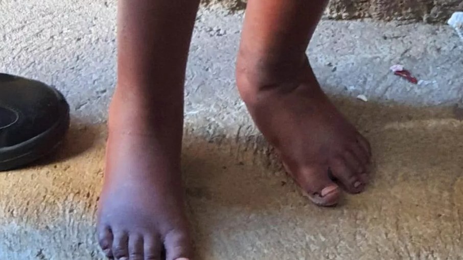 Criança foi mantida em barril por pegar comida sem autorização, diz investigação