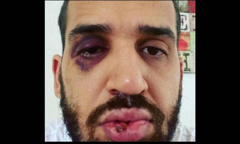 ‘Alertei sobre a pandemia e a resposta foi agressão’, diz médico espancado