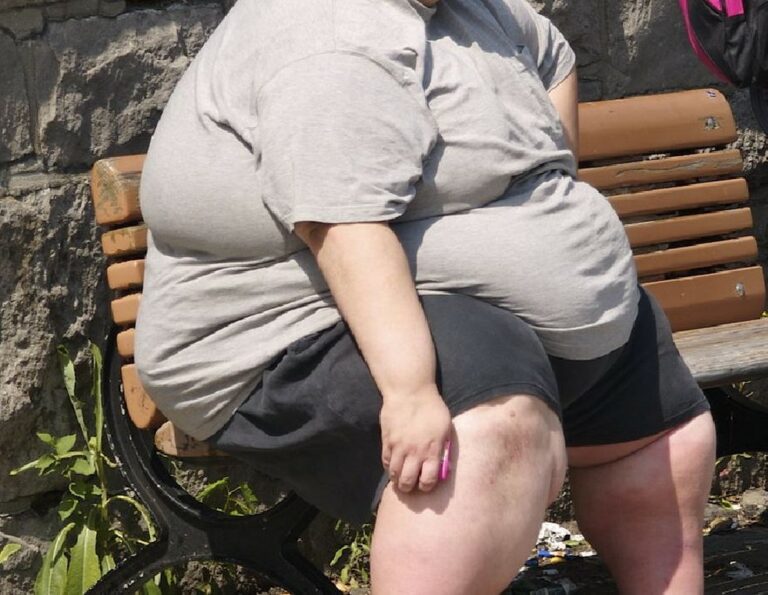 Obesidade é o principal fator de risco em mortes de jovens por Covid-19 no AM, aponta estudo