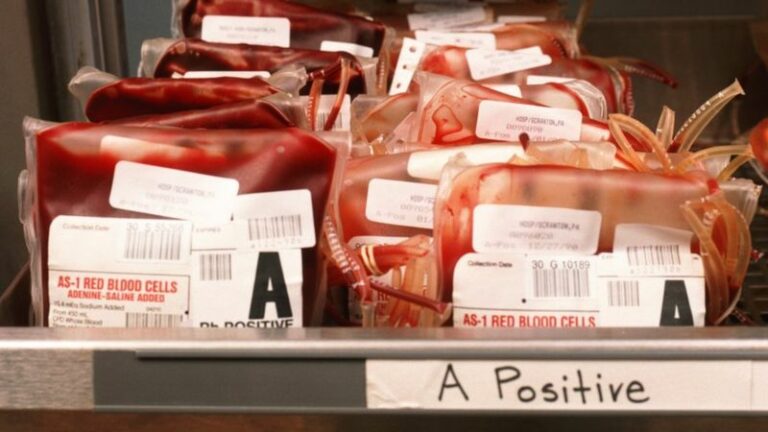 Coronavírus: o que se sabe sobre efeitos de tipos sanguíneos em casos graves de covid-19