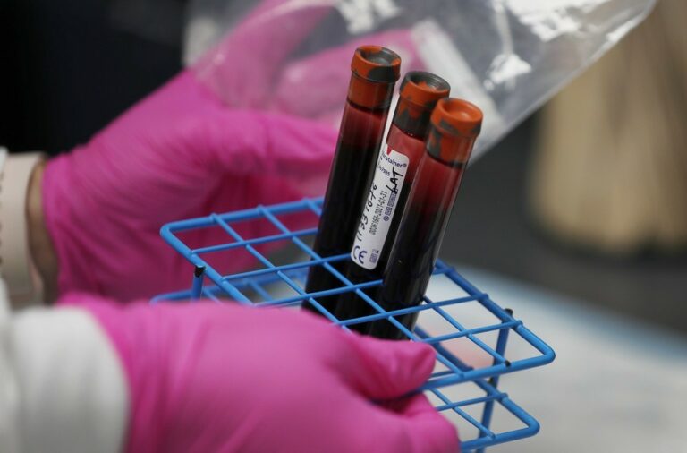 Acre registra 82 novos casos de coronavírus neste domingo