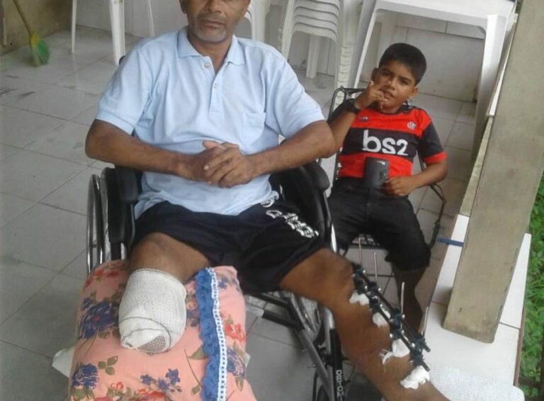 Em Sena, homem que teve as duas pernas quebradas em acidente pede ajuda