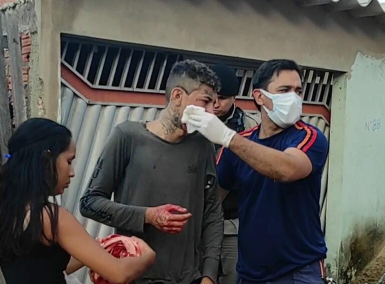 Jovem de 19 anos é atingido com tiro que atravessa o rosto enquanto caminhava em Rio Branco