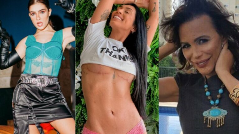 Explante de silicone: famosas contam por que decidiram retirar as próteses