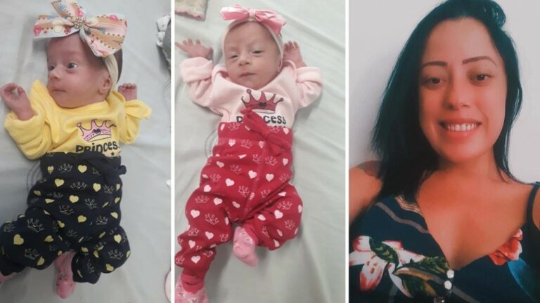 Jovem dá à luz gêmeas e morre de Covid sem conhecer as filhas
